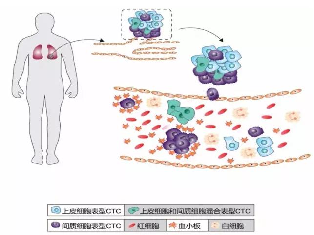 CTC循環腫瘤細胞的分類 CTC循環腫瘤細胞的分類