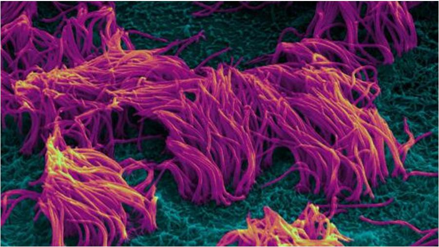 微流控微通道呼吸道芯片 微流控微通道呼吸道芯片