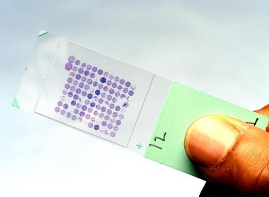 微陣列生物DNA芯片 微陣列生物DNA芯片