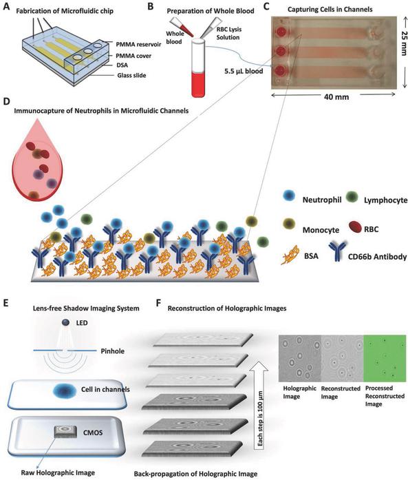 監控血液中嗜中性粒細胞數量的新方法 監控血液中嗜中性粒細胞數量的新方法