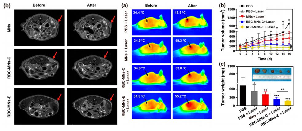 電穿孔包膜技術應用于腫瘤MRI成像與光熱治療 電穿孔包膜技術應用于腫瘤MRI成像與光熱治療