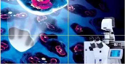 激光顯微切割技術（LCM）