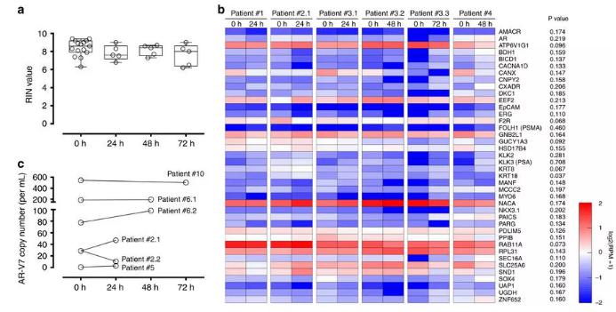 圖:從前列腺癌患者血液中分離出的CTC經(jīng)全血保存后含有完整的RNA,RNA測序和微滴數(shù)字PCR結(jié)果如圖所示。 圖:從前列腺癌患者血液中分離出的CTC經(jīng)全血保存后含有完整的RNA,RNA測序和微滴數(shù)字PCR結(jié)果如圖所示。