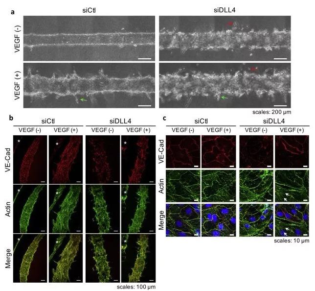 敲除DLL4將影響血管的新生和穩(wěn)定性。圖片來源：EBioMedicine