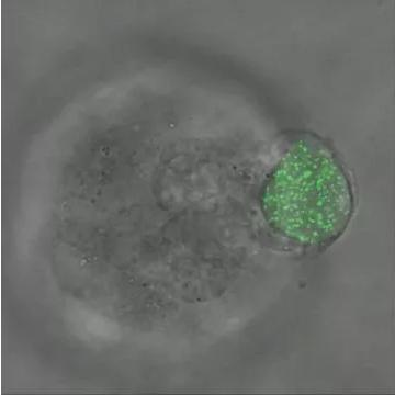 華中科大研發出測量三維生物力的新技術，有望用于癌癥早期診斷