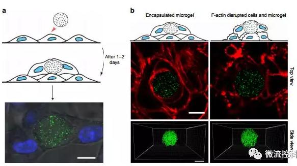 微流控技術(shù)開(kāi)發(fā)微型彈性球,可用于癌癥診斷 微流控技術(shù)開(kāi)發(fā)微型彈性球,可用于癌癥診斷