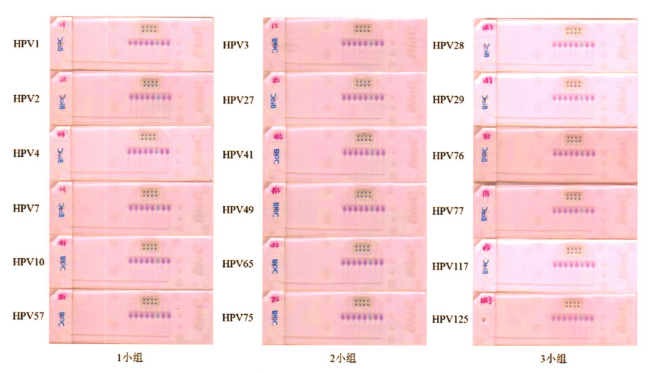 圖2皮膚低危型別中3小組組內(nèi)特異性檢測