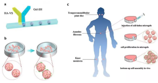 圖1：基于干細胞載體Gel-HA微凝膠的軟骨修復策略示意圖。