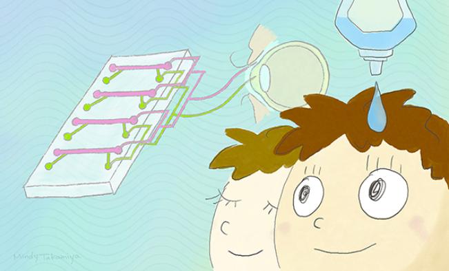 角膜芯片 角膜芯片